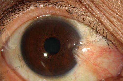 4. 上海黑马眼科——性价比高的全飞秒手术受追捧