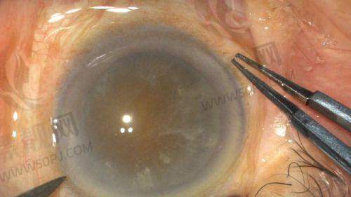 上海眼科医院哪家好不用愁!浦东新区多家眼科医院诊疗技术、评价反馈全解析