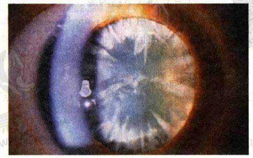 9. 中视眼视光眼科门诊部——重视视觉训练与精细验配