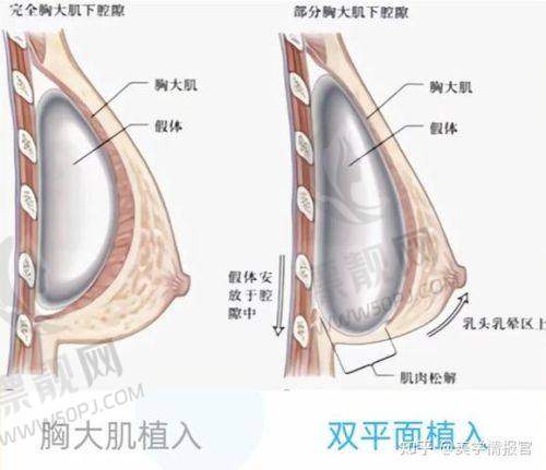 医美机构活动信息