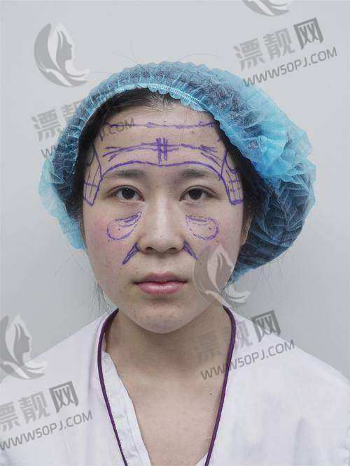 北京润美玉之光整形医院是三甲医院吗?属正规民营机构,价格实惠且医生经验丰富